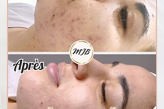 Soin collagène chez MyJaneBeauty à Uccle (Bruxelles-Capitale)